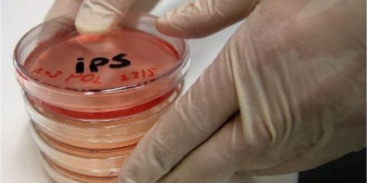 Japón probará células iPS para tratar lesiones de médula espinal