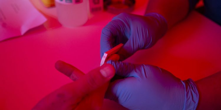 Segundo caso mundial de remisión del virus del sida en un paciente Segundo caso mundial de remisión del virus del sida en un paciente