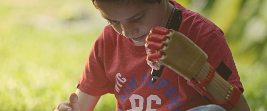 Personas con discapacidad y de escasos recursos podrán acceder a prótesis 3D Personas con discapacidad y de escasos recursos podrán acceder a prótesis 3D