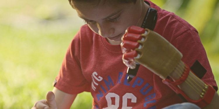 Personas con discapacidad y de escasos recursos podrán acceder a prótesis 3D Personas con discapacidad y de escasos recursos podrán acceder a prótesis 3D