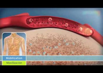 IPS REALIZA TRASPLANTE ALOGÉNICO DE MÉDULA ÓSEA