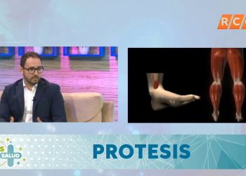 Mas que Salud | Prótesis | RCC 2019