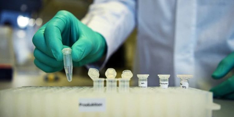 En las próximas semanas más laboratorios privados podrían detectar Covid-19