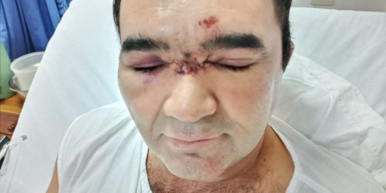 Denuncian a agentes policiales por supuesto uso excesivo de la fuerza en Filadelfia