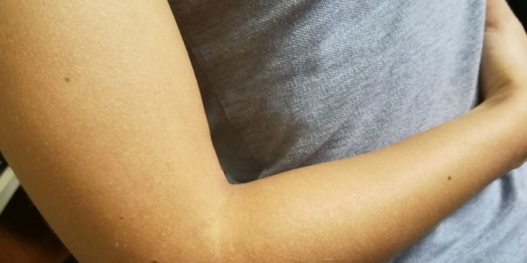 Conozca más acerca de los cuidados de la piel durante el verano Conozca más acerca de los cuidados de la piel durante el verano