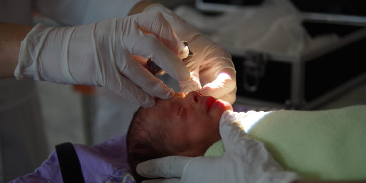 Fundación Visión trabaja para prevenir la ceguera irreversible en bebés prematuros