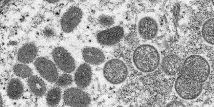 Viruela del mono, el virus en investigación
