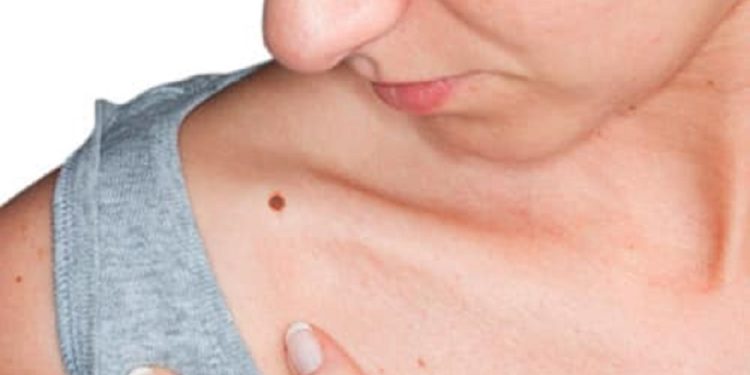 Prestale atención a tu piel Prestale atención a tu piel