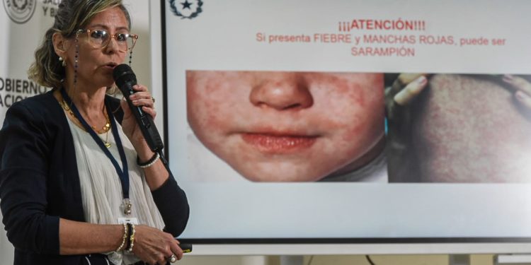 Confirman caso único de sarampión tras 22 años y se intensifica vigilancia Confirman caso único de sarampión tras 22 años y se intensifica vigilancia