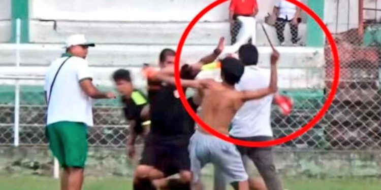 Copa Perú: Árbitro sufrió una brutal agresión con un machete Copa Perú: Árbitro sufrió una brutal agresión con un machete
