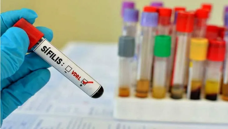 Alta tendencia de sífilis y sífilis congénita en el país