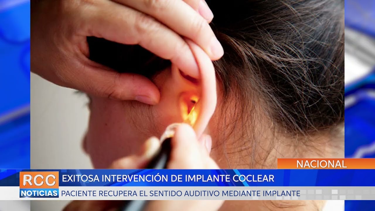 Hospital de Clínicas realiza implante coclear a paciente con sordera progresiva