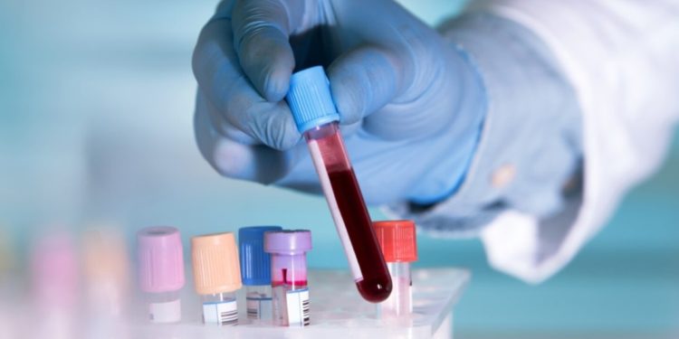 Médicos abogan por la concientización acerca de los tipos de cáncer de la sangre