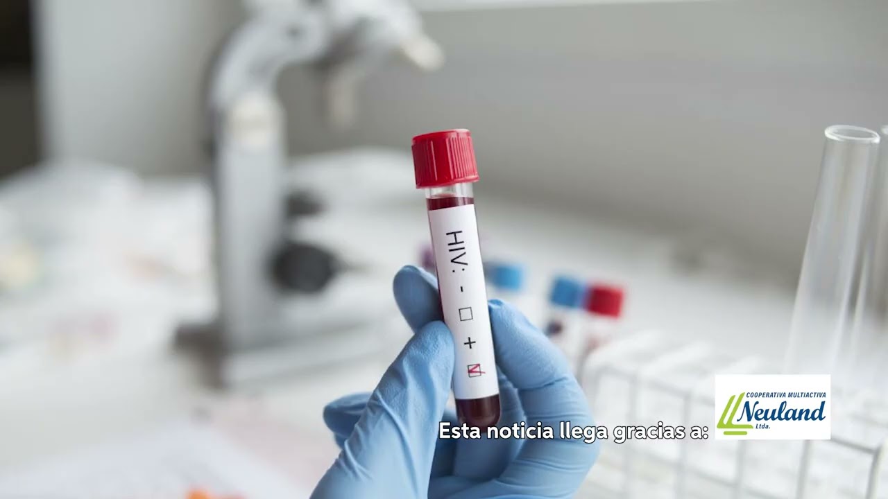 Especialistas advierten sobre epidemia de VIH, ante aumento sostenido de casos en el país