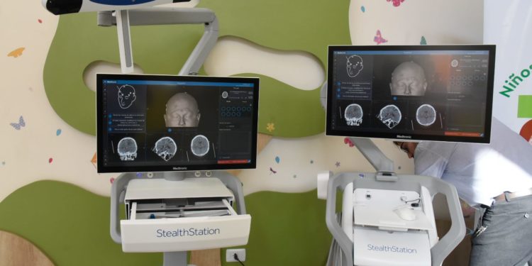 Entregaron primer neuronavegador del sistema de Salud Pública al Hospital General Pediátrico “Niños de Acosta Ñu”