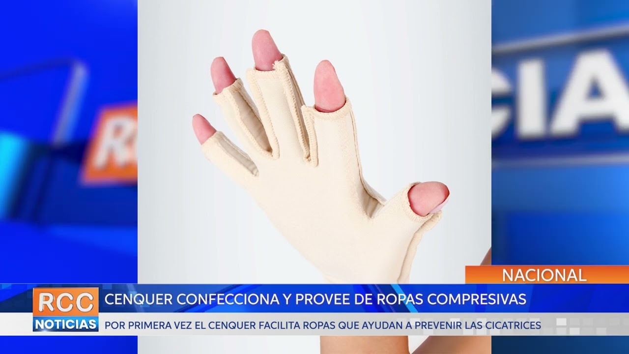 El Centro Nacional de Quemaduras confecciona y provee de ropas compresivas a sus pacientes