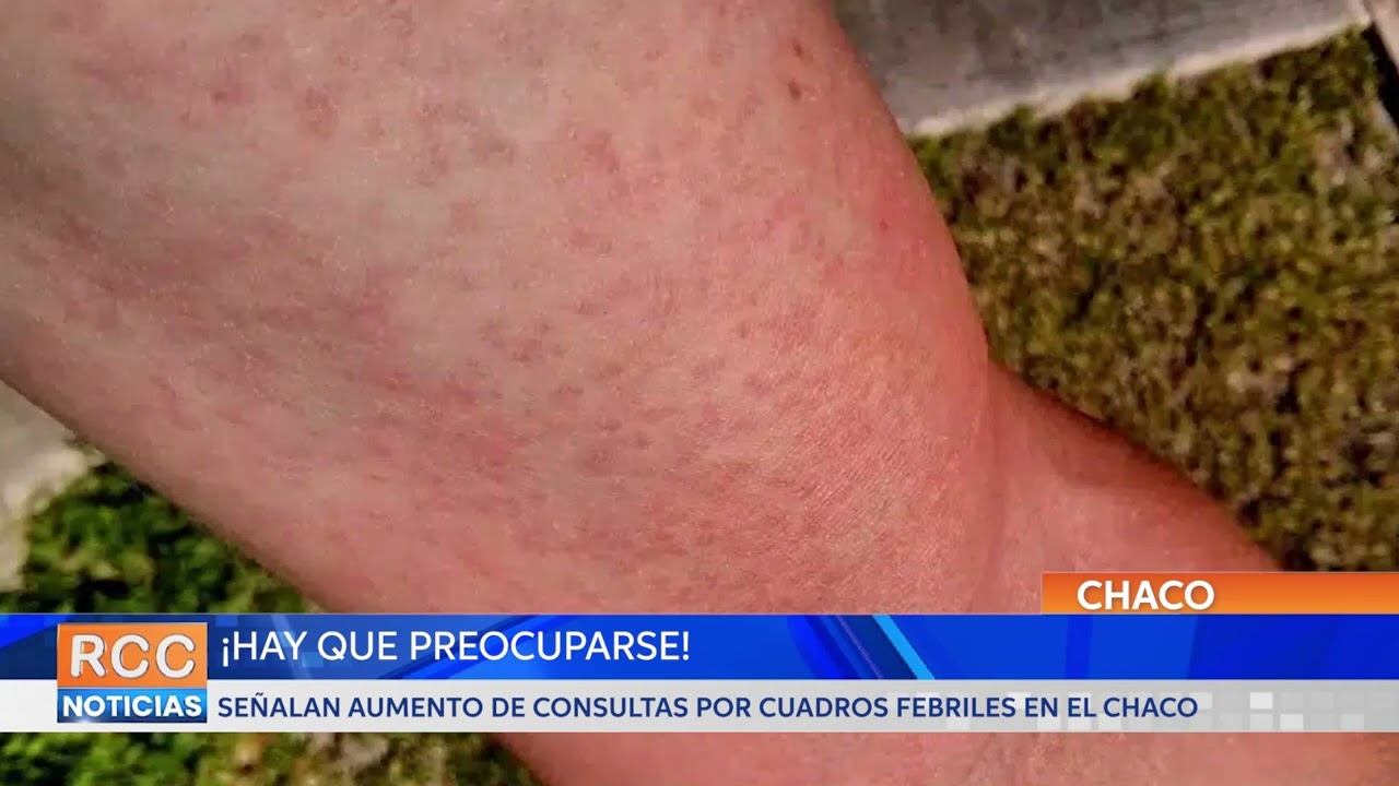 ¡Hay que preocuparse! Señalan aumento de cuadros febriles posiblemente por Dengue en el Chaco