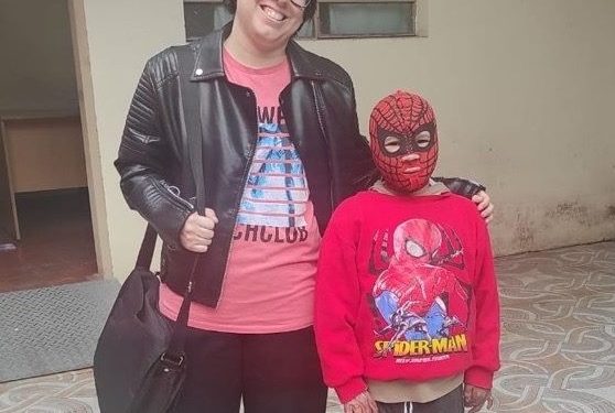 Ropas compresivas gratuitas: aliadas en la recuperación de quemaduras