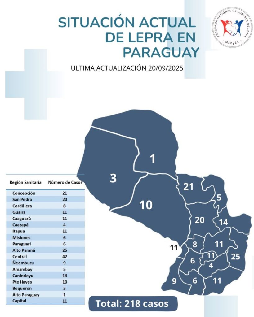 Lepra: notificaciones de casos se mantienen dentro de lo esperado, según el Ministerio de Salud Pública Lepra: notificaciones de casos se mantienen dentro de lo esperado, según el Ministerio de Salud Pública