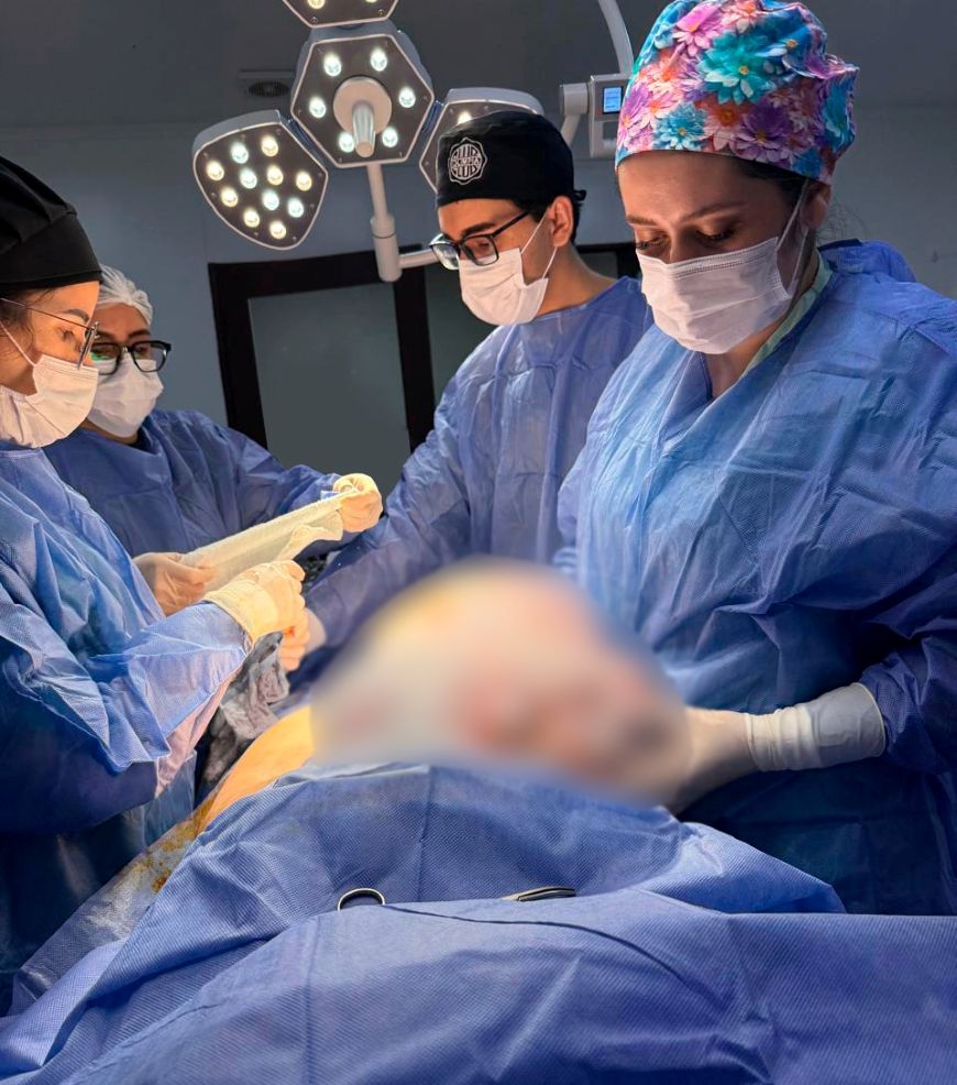 Hospital Regional de Pedro Juan Caballero realiza con éxito la extracción de un tumor ovárico de 11 kilos