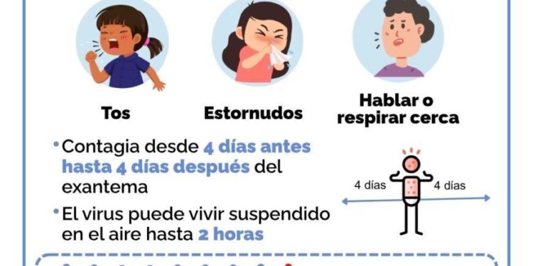 Brote de sarampión se expande a Central y eleva a 45 los casos en Paraguay Brote de sarampión se expande a Central y eleva a 45 los casos en Paraguay
