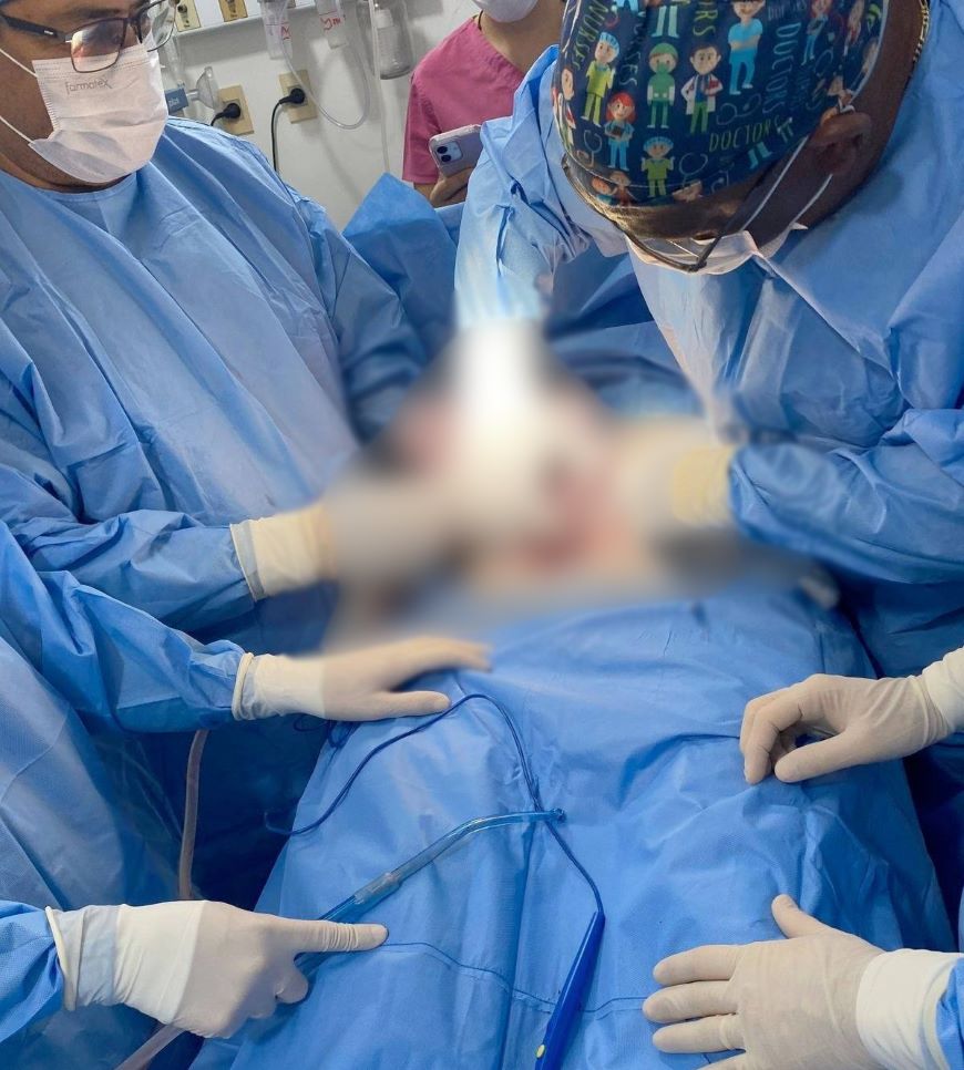 Éxito médico en Villa Elisa: Extraen enorme tumor uterino de casi 4 kilos
